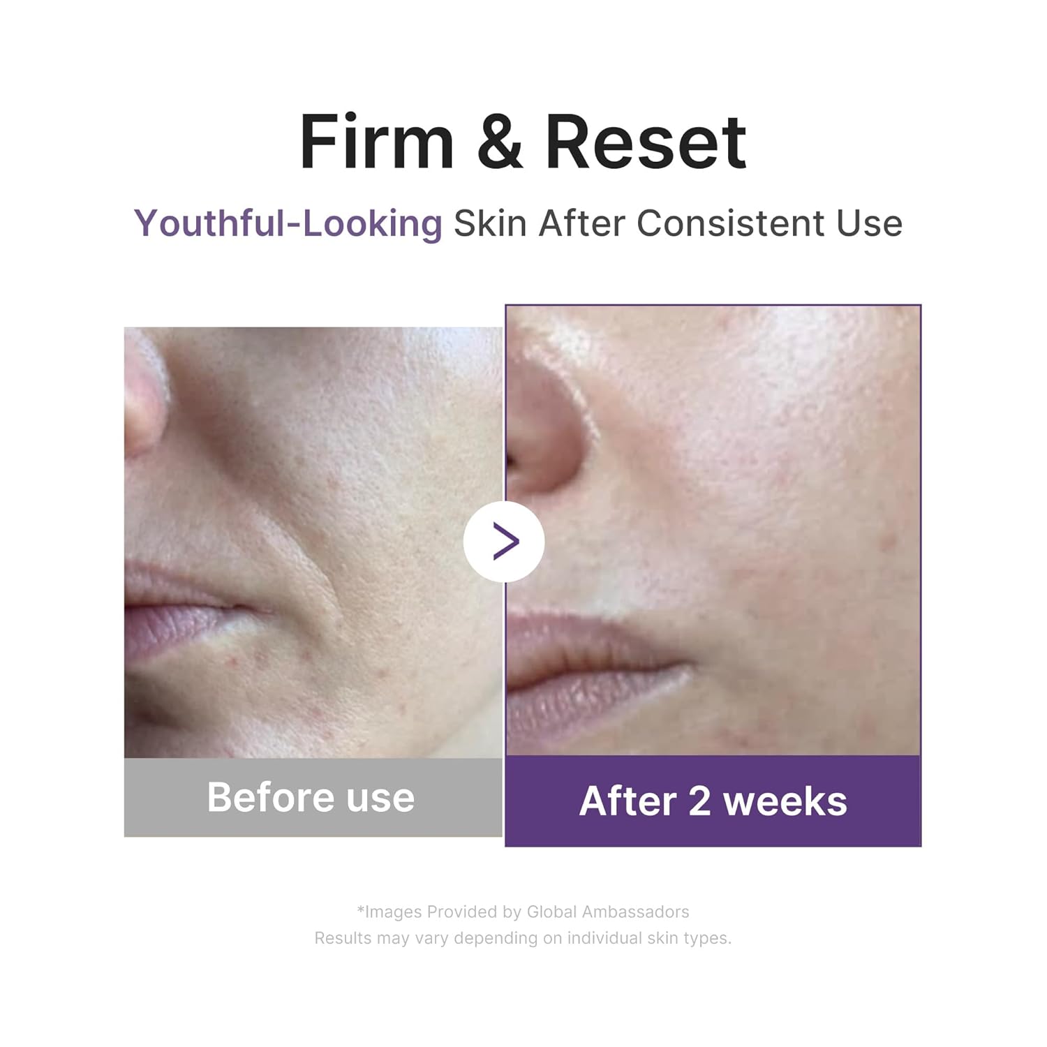 medicube Retinol Boosting Serum | 1.9% Retinol-Some