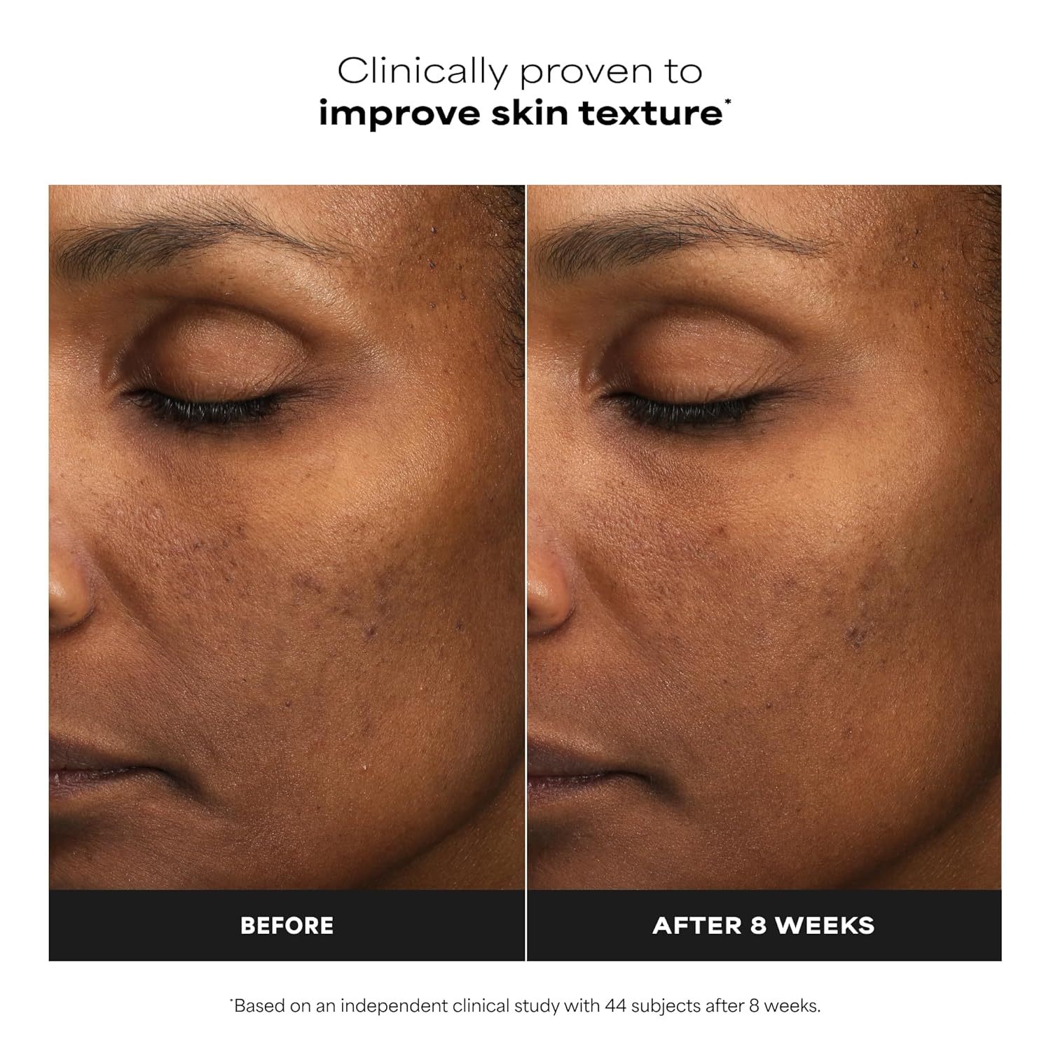Paula's Choice Skin Perfecting 6% Mandelic Acid + 2% Lactic Acid Liquid Exfoliant
