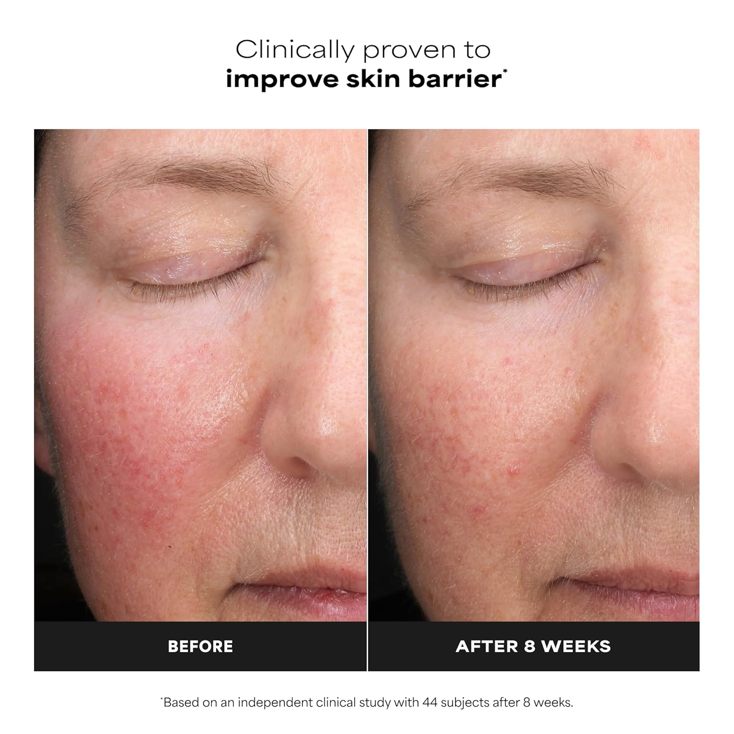 Paula's Choice Skin Perfecting 6% Mandelic Acid + 2% Lactic Acid Liquid Exfoliant
